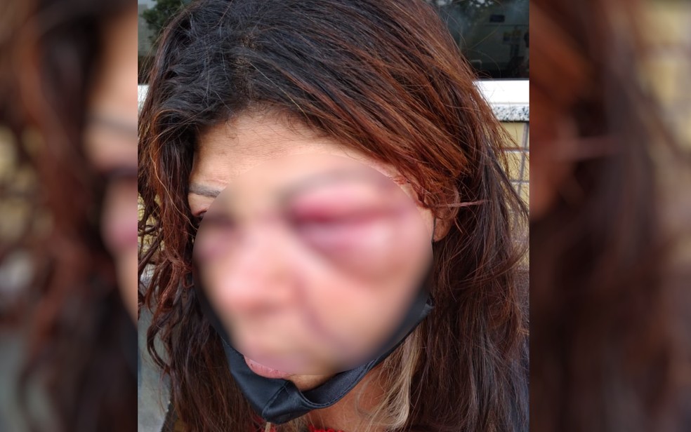 Mulher que foi espancada pelo genro ao tentar defender filha só não morreu porque neto interveio, diz filha