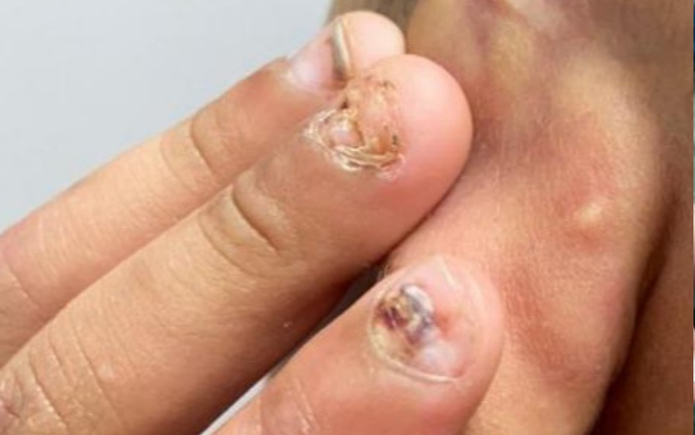 Avó diz que menino torturado pelo pai está traumatizado com agressões e sente dores