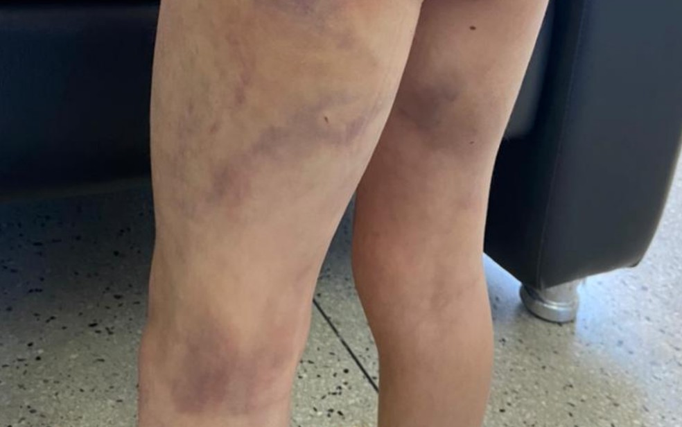 Mãe e companheira são suspeitas de agredir irmãos após diretora notar ferimentos, em Aparecida de Goiânia