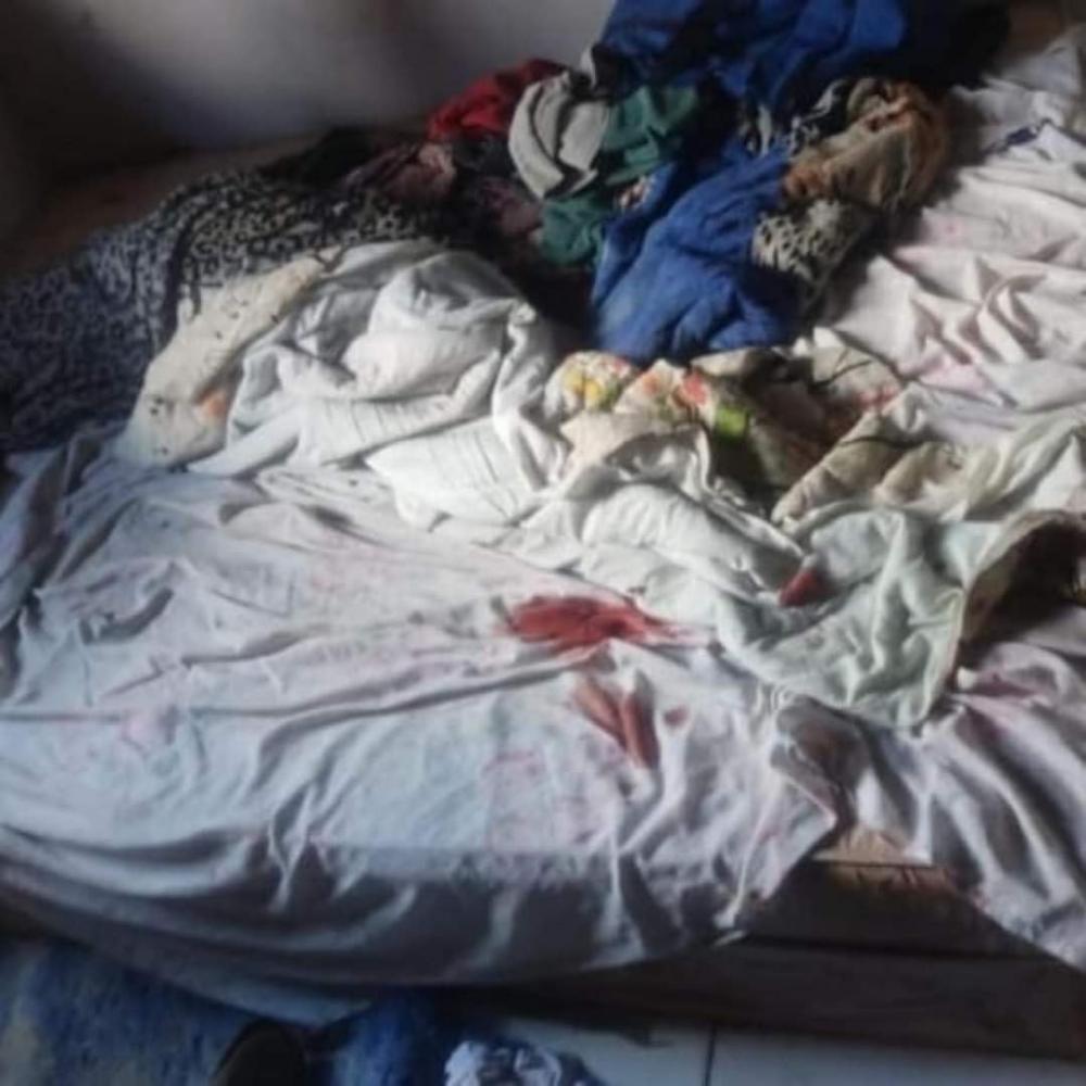 Homem é esfaqueado pelo irmão, ao tentar intervir em discussão de casal em Aparecida do Rio Doce