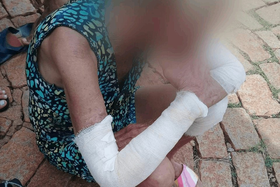 Idosa proíbe o filho de levar namorada em casa e é agredida, em Inhumas