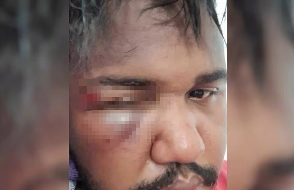 Funcionário denuncia que foi espancado dentro de supermercado, em Inhumas (GO)