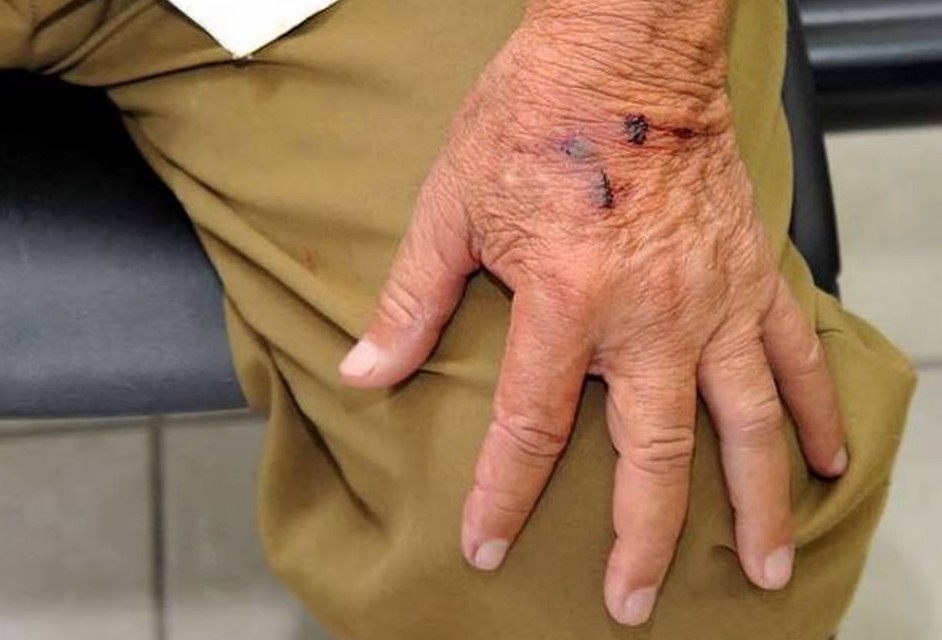 “Ele está chateado”, alega vizinha sobre idoso que foi roubado e agredido, em Anápolis