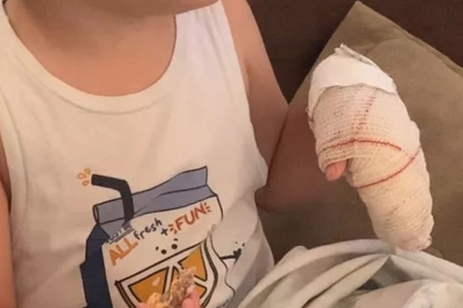 Menino amputa parte do dedo após ter mão prensada em Cmei de Goiânia; professora é investigada