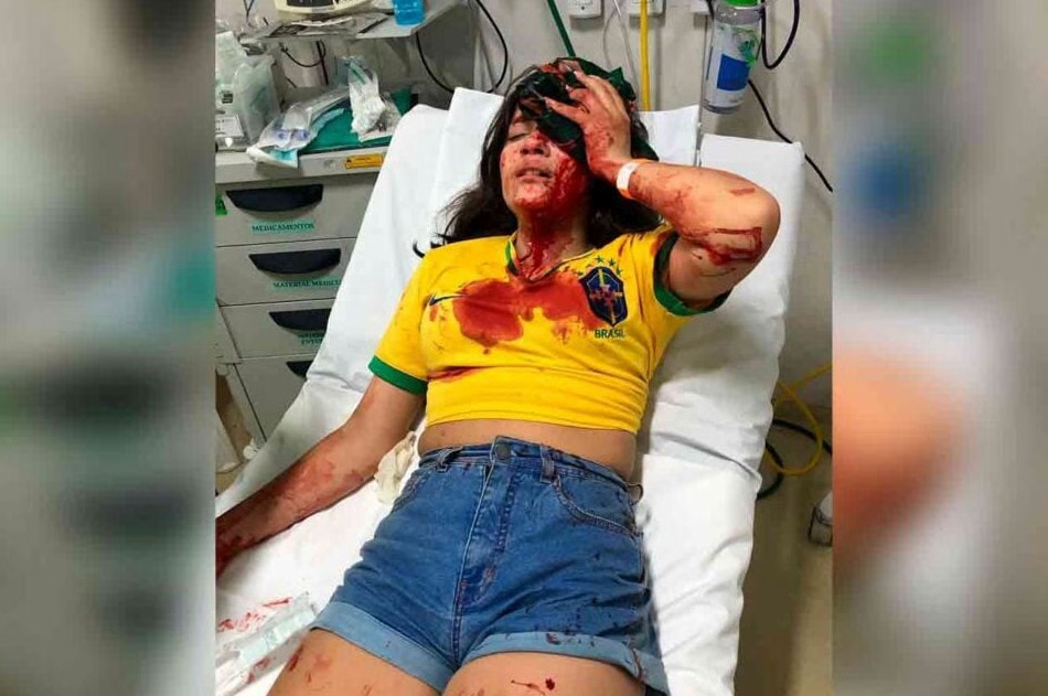 Adolescente é atingida por pedrada quando participava de carreata pró-Bolsonaro