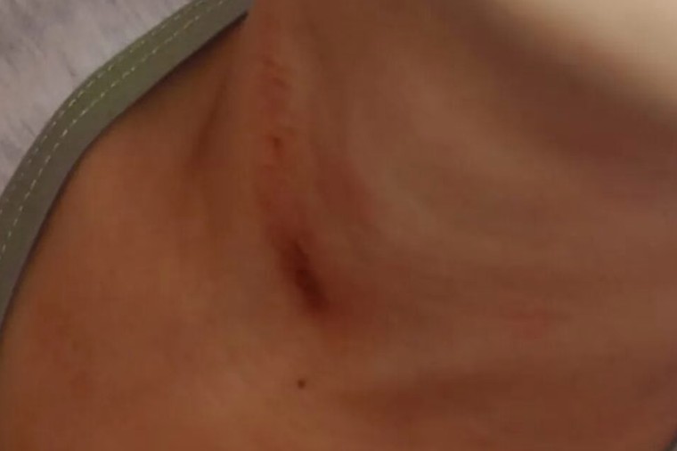 Mãe denuncia que filho de 7 anos foi enforcado por PM depois de dizer ‘Lula lá’