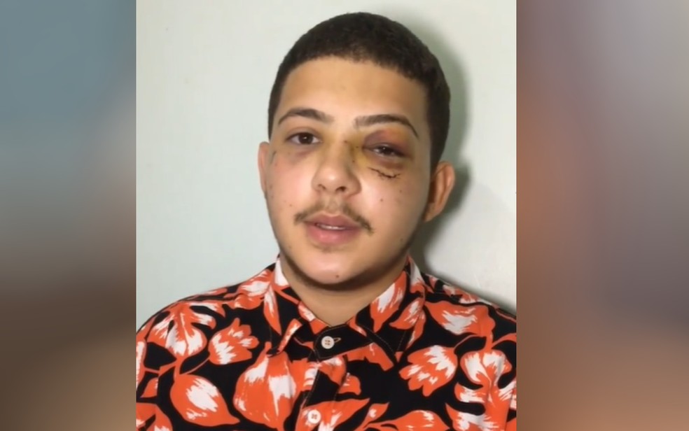 Jovem denuncia que foi agredido com socos por cantor em posto de combustíveis