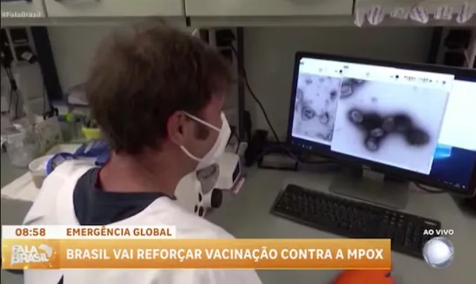 Risco de transmissão da Mpox é baixo no Brasil