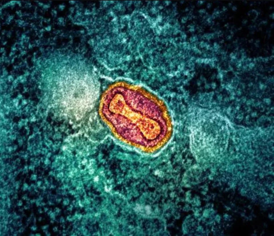 ‘Não acredito em uma onda avassaladora’ de mpox no Brasil, diz cientista consultora da OMS