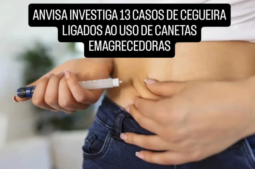 Anvisa investiga 13 suspeitas de perda de visão ligadas a canetas emagrecedoras