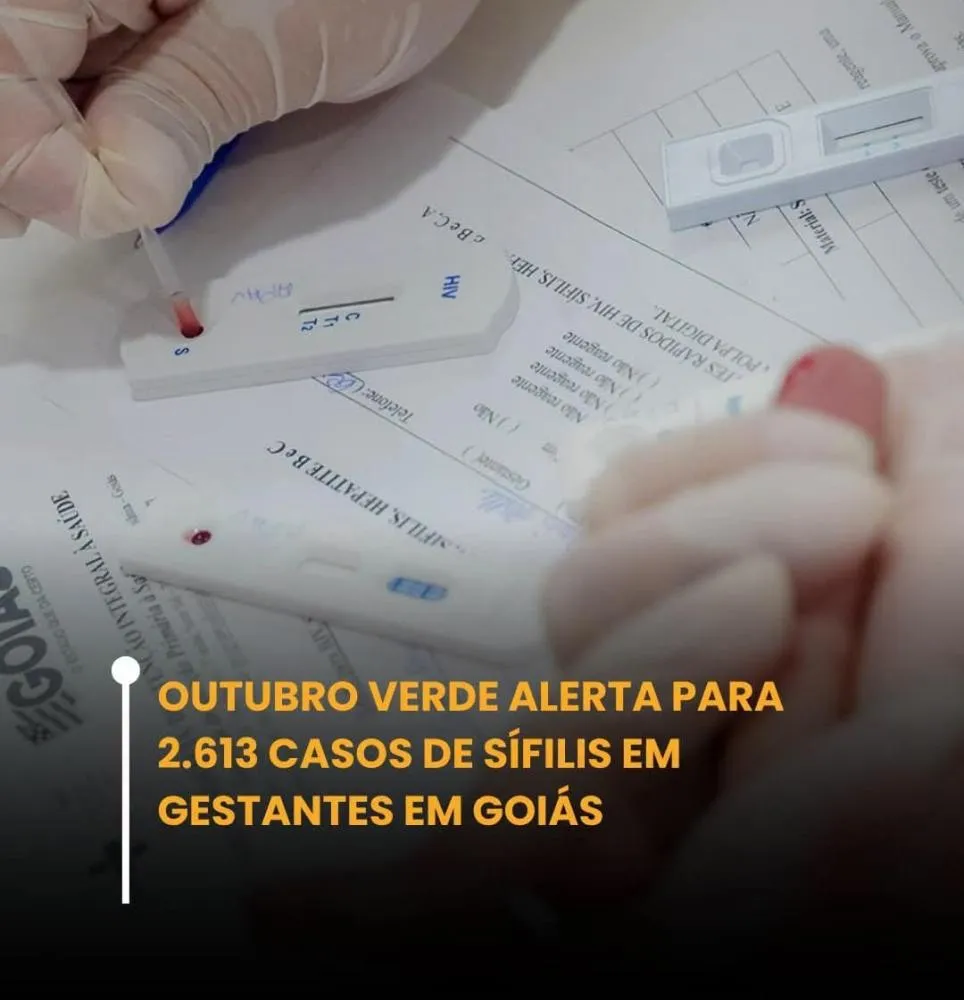Goiás contabiliza mais de 2,6 mil casos de sífilis em gestantes e alerta para testagem no pré-natal