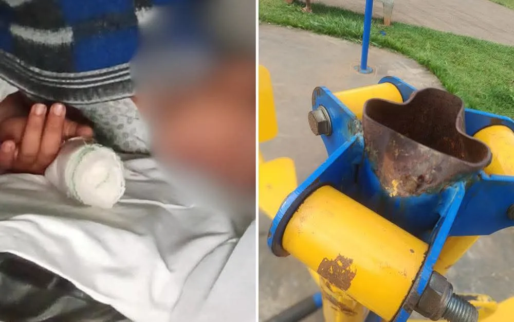 Criança de 6 anos passa por cirurgia após acidente em brinquedo de praça pública