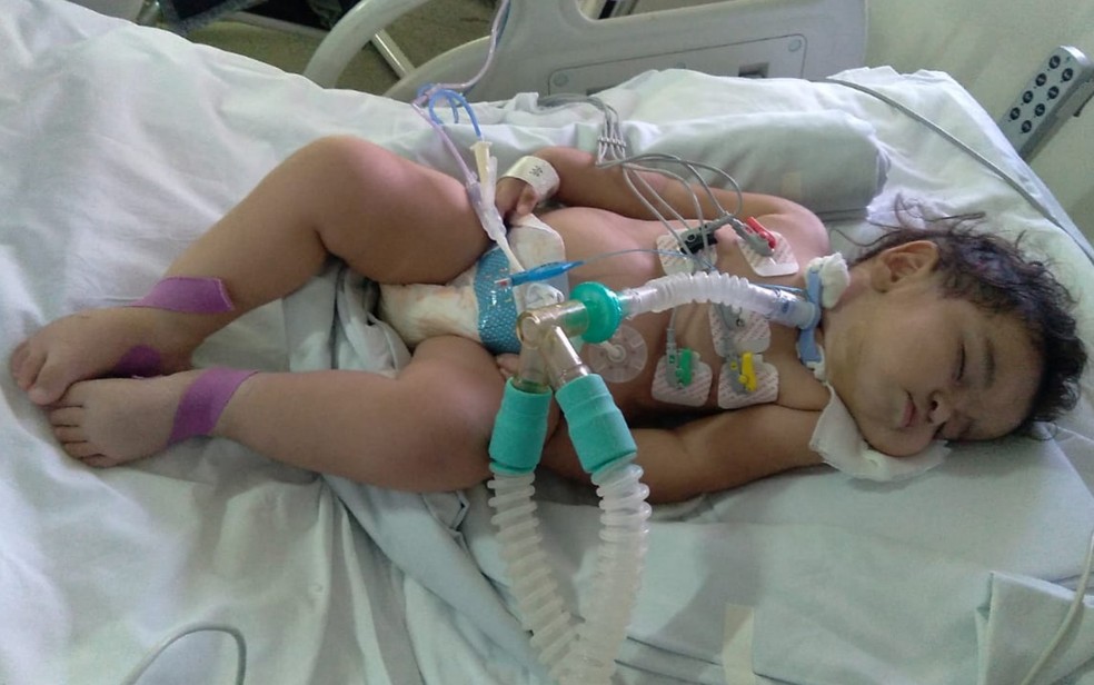 Mãe luta há quatro meses para conseguir respirador para poder levar bebê para casa