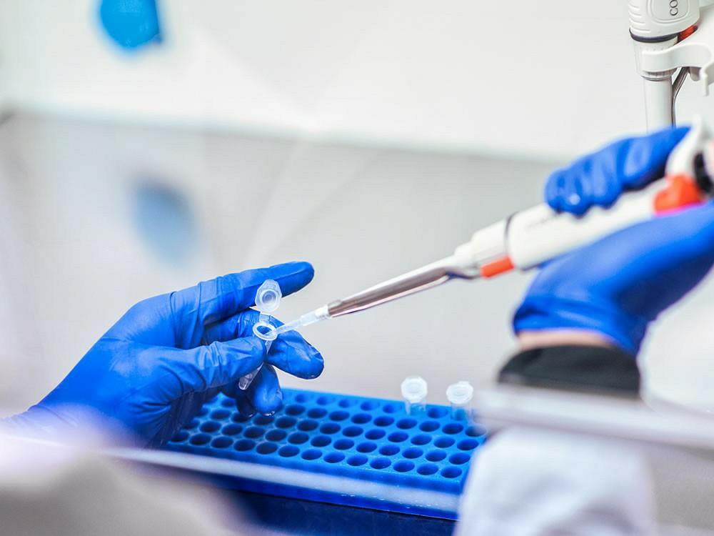 Cientistas criam testes de covid-19 com resultados em tempo recorde